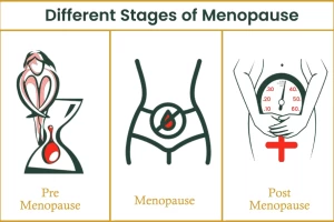 Through symptoms, know at which stage of menopause are you on
